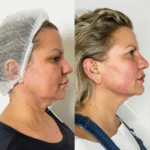 Innovative Cosmetic Solutions by the Best Plastic Surgeons in Dubai