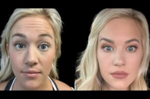 The Role of Technology in the Success of the Best Aesthetic Clinic in Dubai