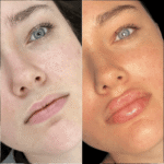 Best Doctors in Dubai for Fillers and Beauty Enhancements