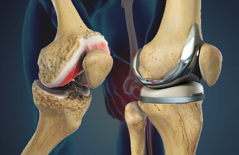 Best Orthopedic Surgeon in Vaishali Nagar Jaipur – Expert Joint & Bone Care by Dr. Arvind Asopa