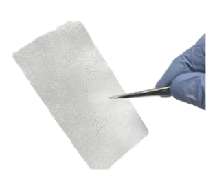 How Amniotic Allografts Are Transforming Modern Wound-Care Solutions