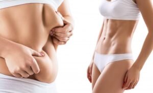 What Makes the Best Doctors in Dubai Stand Out in Liposuction Surgery