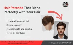Best Affordable Hair Patch in Jaipur for Men & Women – Empire Hair Fixing Studio