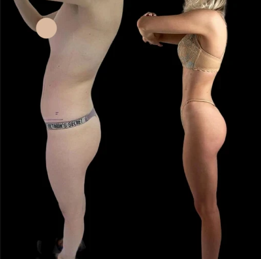 What to Expect from J-Plasma Treatments in Dubai