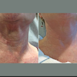 Skin Tightening Treatments in Dubai for Long-Term Skin Rejuvenation
