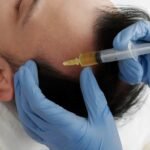 Say Goodbye to Flakes: The Best Dandruff Treatment in Calicut | Charmama Esthetics and Wellness