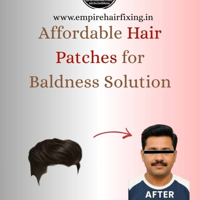 Hair Patch Care Tips: Make It Look Natural & Long-Lasting