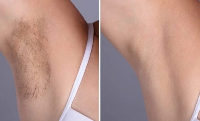 Best Plastic Surgeons in dubai Using Latest Laser Hair Removal Systems
