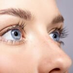 Upper Eyelid Surgery in London: How Is Eyelid Structure Assessed During Consultation?