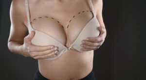 Breast Enlargement Dubai: How Are Personal Expectations Evaluated Before Treatment?