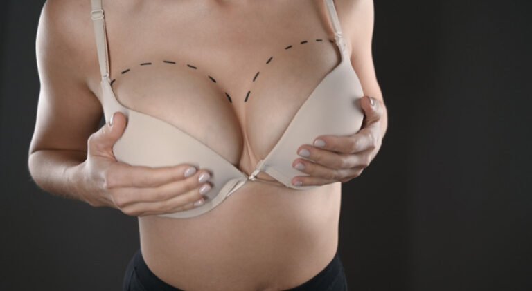 Breast Enlargement Dubai: How Are Personal Expectations Evaluated Before Treatment?