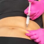 How Treatment Goals Shape Lipolysis Injection In Dubai