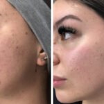 The Benefits of Medical Grade Skincare Before and After Procedures