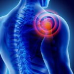 Stem Cell Therapy for Rotator Cuff in Hyderabad | Advanced Non-Surgical Treatment