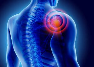 Stem Cell Therapy for Rotator Cuff in Hyderabad | Advanced Non-Surgical Treatment