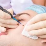 Skin Tags Removal in Dubai: Treatment Options and Aftercare