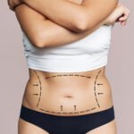 Tummy Tuck in Dubai for Personalized Abdominal Enhancement