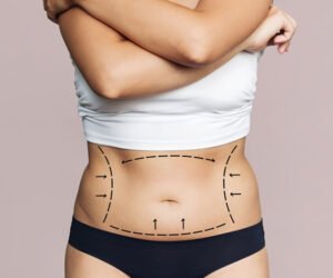 Tummy Tuck in Dubai for Personalized Abdominal Enhancement
